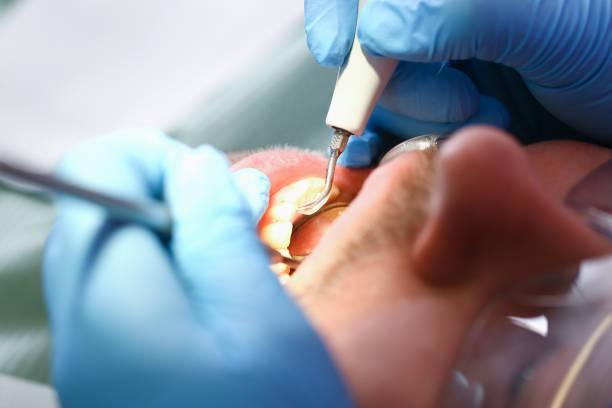 Best Emergency Gum Treatment in Sterling Heights, MI